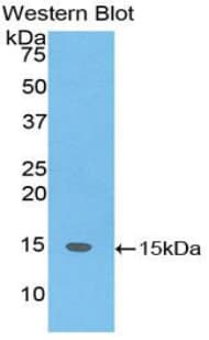 SH2D1A / SAP Antibody (aa18-115, FITC)