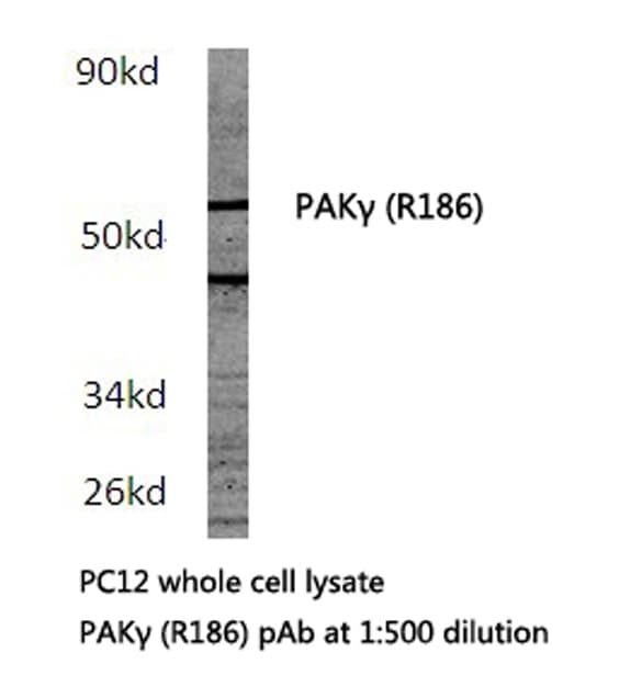 Polyclonal Rabbit anti-Human PAK2 Antibody (Arg186, IHC, WB)