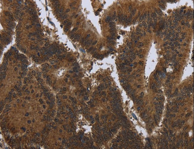 PIP / GCDFP-15 Antibody