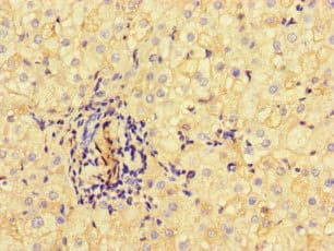 ALB / Serum Albumin Antibody