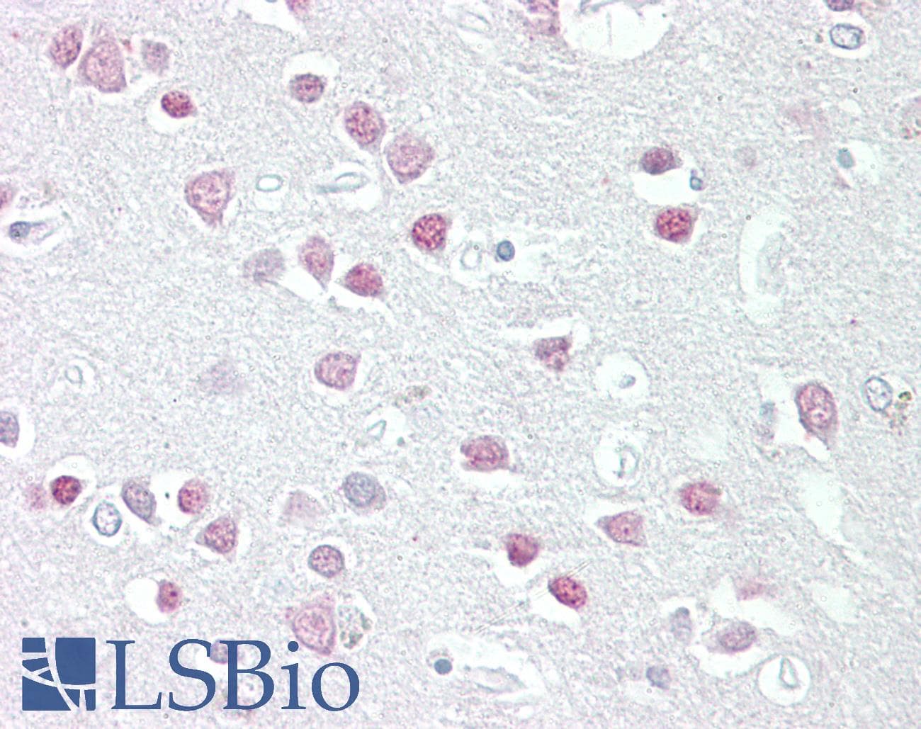 IHC-plus™ MC5R / MC5 Receptor Antibody (aa24-35)