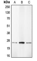 Polyclonal Rabbit anti-Human CASP1 / Caspase 1 Antibody (Internal, IHC, WB)