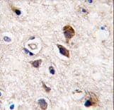 PRKCG / PKC-Gamma Antibody (aa305-336)