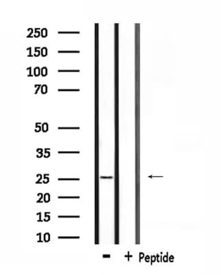 Polyclonal Rabbit anti-Human RAB38 Antibody (IF, WB)