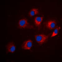 IRS1 Antibody (phospho-Ser794)