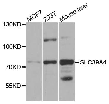 IHC-plus™ SLC39A4 / ZIP4 Antibody