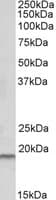 IHC-plus™ Polyclonal Goat anti-Human SPINT2 / HAI-2 Antibody (aa111-122, IHC, WB)