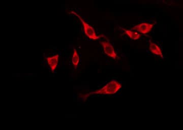 Polyclonal Rabbit anti-Human TAS2R10 / TRB2 Antibody (IF, WB)
