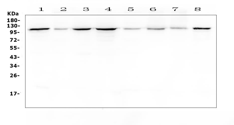 Polyclonal Rabbit anti-Human HSPH1 / HSP105 Antibody (IHC, WB)