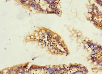 Polyclonal Rabbit anti-Human TRPM4 Antibody (IHC)
