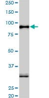 IHC-plus™ SRPK1 Antibody (clone 6H5)