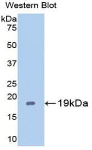 CASP2 / Caspase 2 Antibody (aa170-333, Cy3)