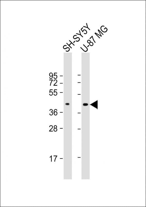 GPR45 Antibody (aa 121-149, Internal)