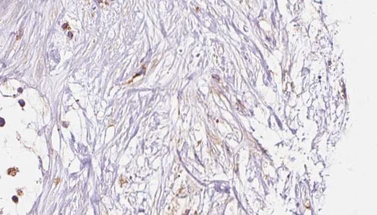Polyclonal Rabbit anti-Human HLA-F Antibody (IHC, IF, WB)