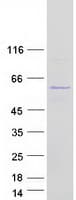 Human UBXN6 / UBXD1 Protein (Recombinant Myc-DDK (Flag))