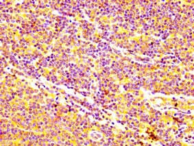 Polyclonal Rabbit anti-Human ABCC5 / MRP5 Antibody (IHC)