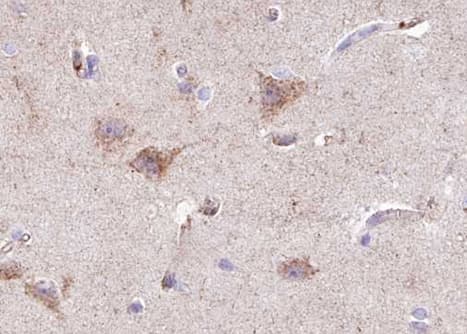 INSR / Insulin Receptor Antibody (phospho-Tyr1355)