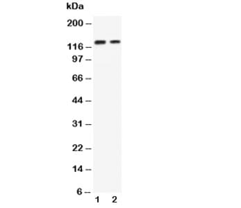 Polyclonal Rabbit anti-Human CDH3 / P-Cadherin Antibody (aa612-626, IHC, WB)