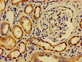 SREBF2 / SREBP2 Antibody