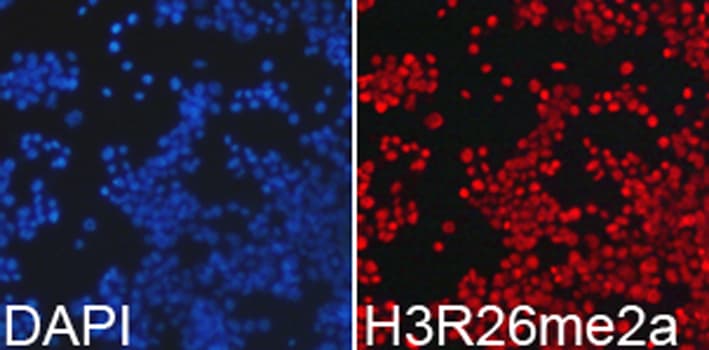 Histone H3 Antibody (Asym-Di-Methyl-Arg26)