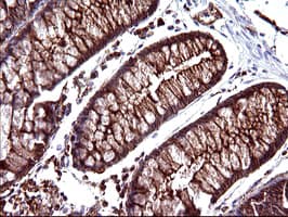 SCAMP2 Antibody (clone OTI3C2)