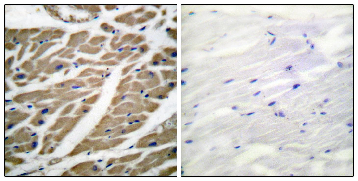 SCN5A / Nav1.5 Antibody