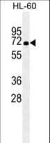 IHC-plus™ Heat Shock Protein 70 / HSPA1A Antibody (aa574-600, clone 201CT8.2.3)