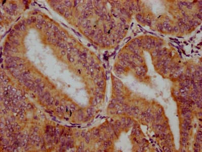 Polyclonal Rabbit anti-Human TRIM26 Antibody (IHC)