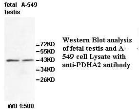 PDHA2 / PDH E1 Beta Antibody (aa42-389)
