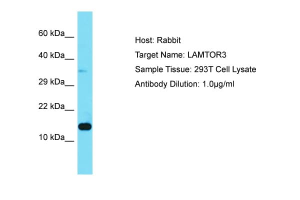 LAMTOR3 / MP1 Antibody (aa13-62)