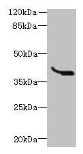Polyclonal Rabbit anti-Human LRTM1 Antibody (IHC, WB)