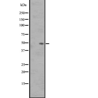 Polyclonal Rabbit anti-Human SSTR3 Antibody (IHC, WB)