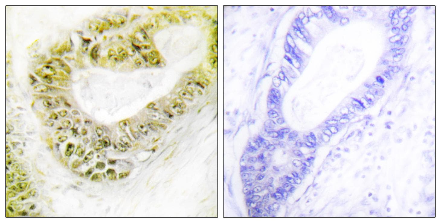 ZNF638 Antibody