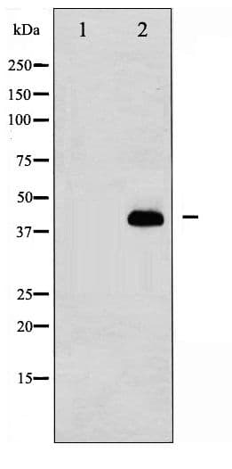 MAP2K1 / MKK1 / MEK1 Antibody (phospho-Thr291)