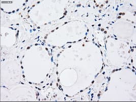 Monoclonal Mouse anti-Human MAP2K4 / MKK4 Antibody (clone OTI8A8, IHC, IF, WB)