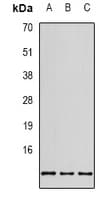 Polyclonal Rabbit anti-Human RPS20 / Ribosomal Protein S20 Antibody (Internal, IHC, IF, WB)