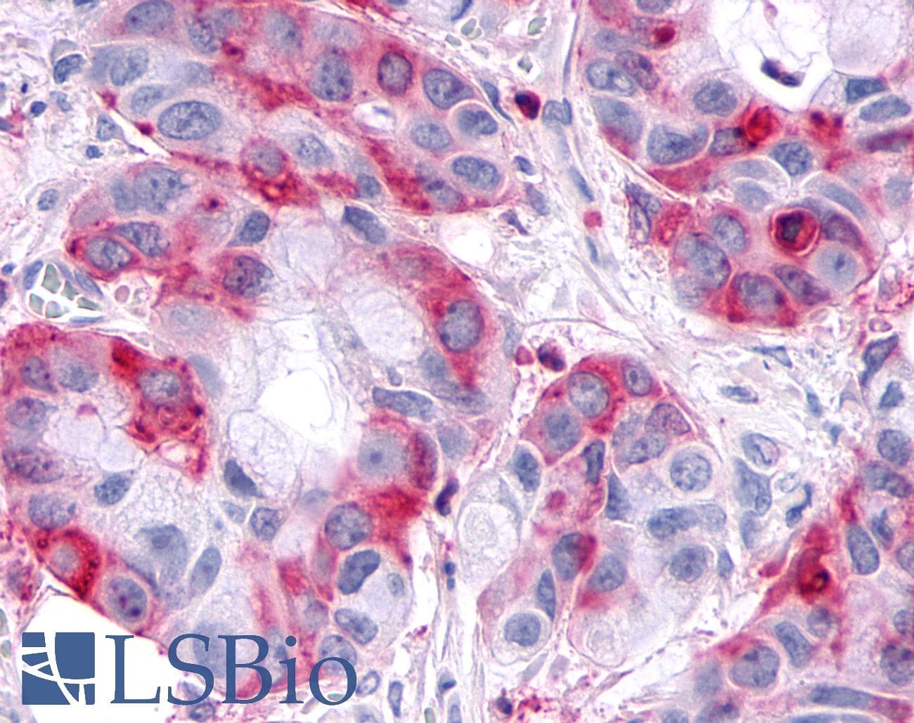 PathPlus™ SGK3 Antibody (N-Terminus)