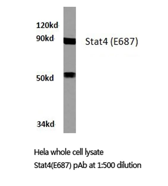 STAT4 Antibody (Glu687)