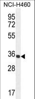 IHC-plus™ Polyclonal Rabbit anti-Human PRSS1 / Trypsin Antibody (aa81-107, IHC, WB)