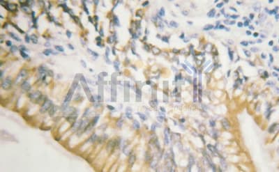 Polyclonal Rabbit anti-Human c-Met Antibody (phospho-Tyr1003, IHC, IF, WB)