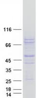 Human PCSK2 Protein (Recombinant Myc-DDK (Flag))