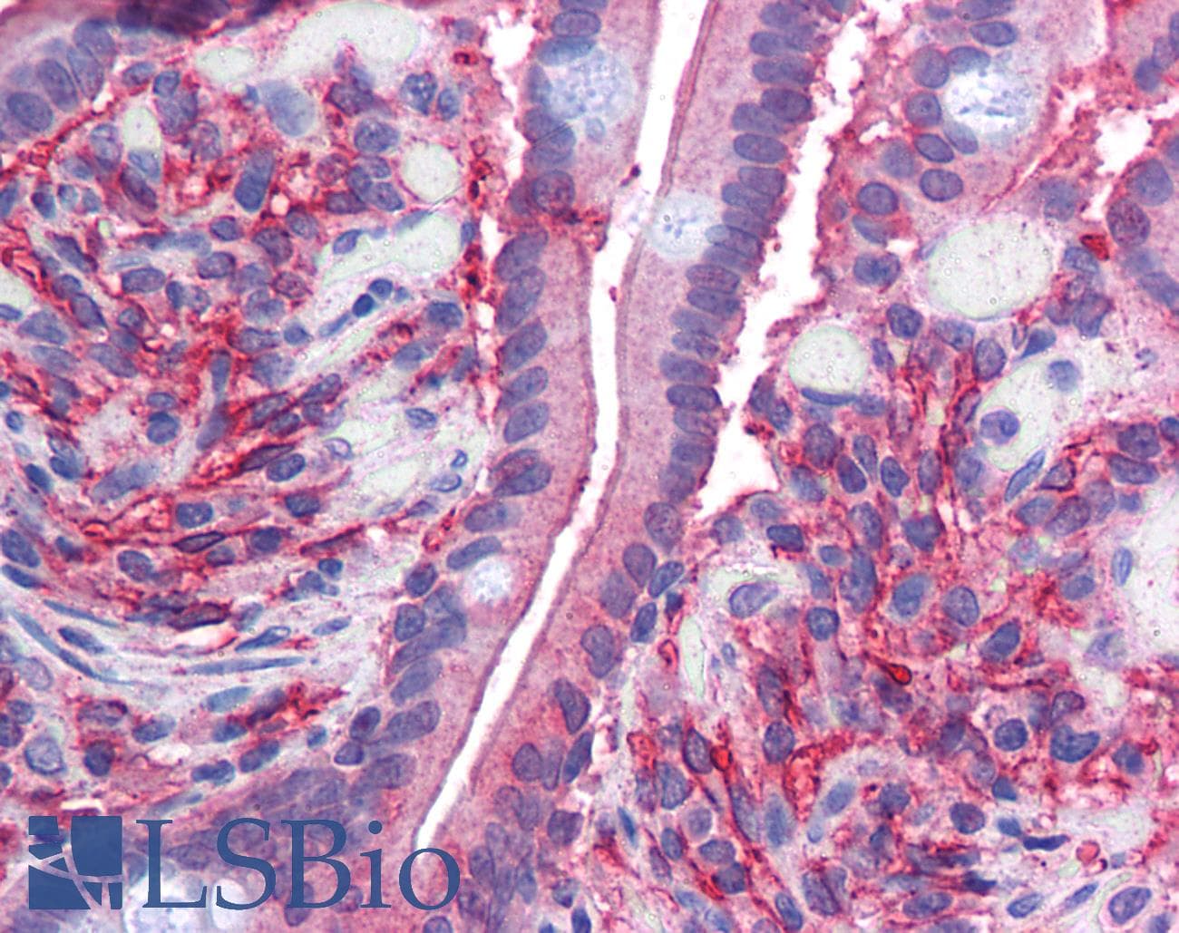 IHC-plus™ Polyclonal Goat anti-Human DCYTB / CYBRD1 Antibody (aa273-286, IHC)