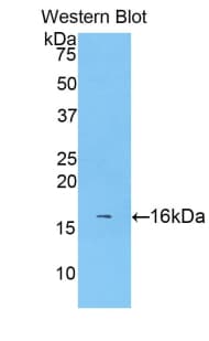CALCB Antibody (aa1-127, Biotin)
