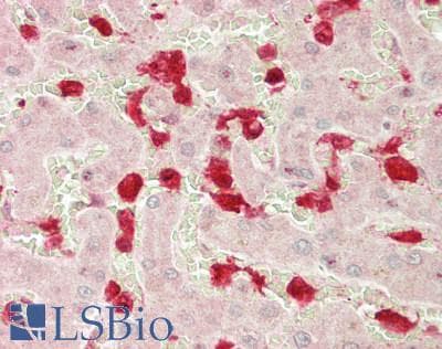 IHC-plus™ Calgizzarin / S100A11 Antibody