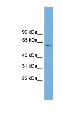 ZBTB46 Antibody (aa179-228)