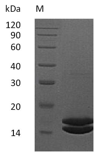 Human IL2 Protein (Recombinant 6His, C-terminus)