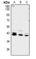 Polyclonal Rabbit anti-Human RCL1 Antibody (WB)