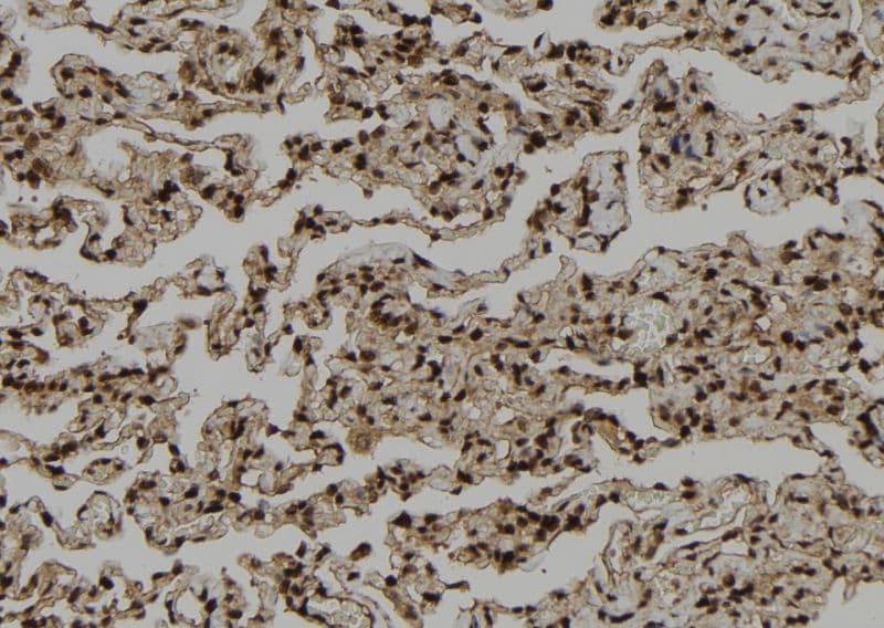 PSKH1 Antibody