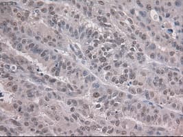 NOTCH1 Antibody (clone OTI4C9)