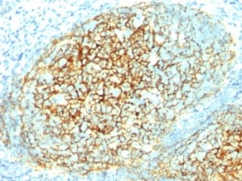 VCAM1 / CD106 Antibody (clone 1.4C3)